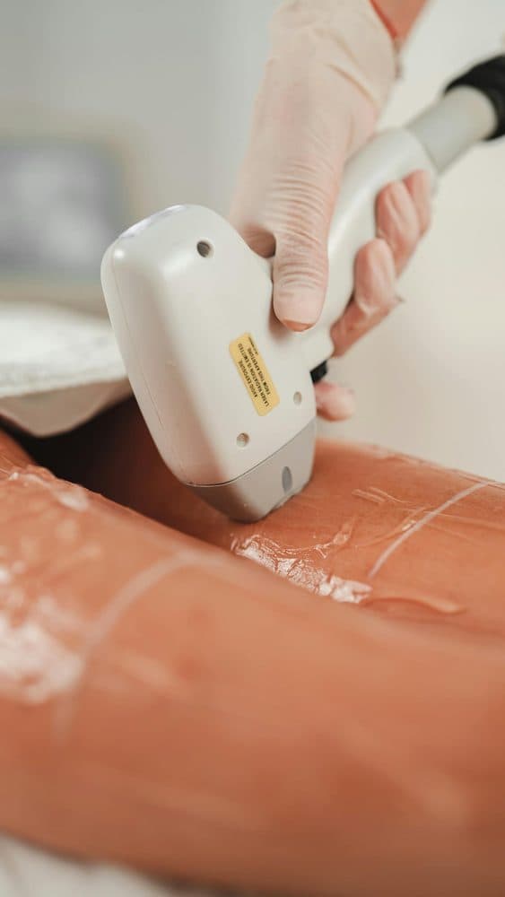 laser hair removal Cambridge clinic